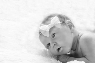 孕期妊娠合并新生儿鸟氨酸转移酶缺乏症怎么低蛋白饮食 孕期妊娠合并新生儿鸟氨酸转移酶缺乏症怎么低蛋白饮食